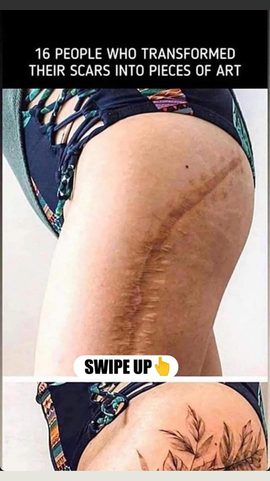 Tattoos can help you turn scars into something beautiful