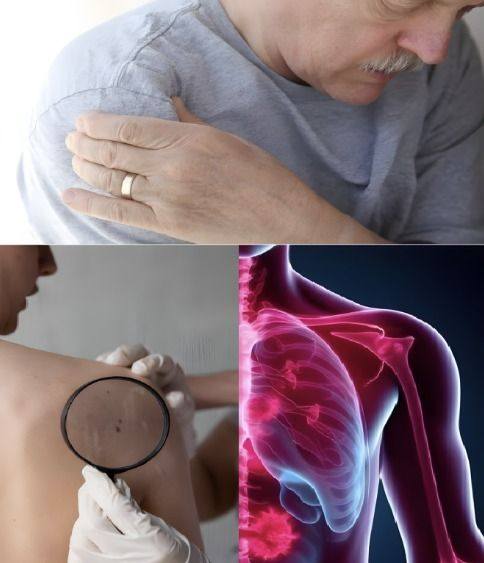 16 Early Signs Cancer Is Growing in Your Body