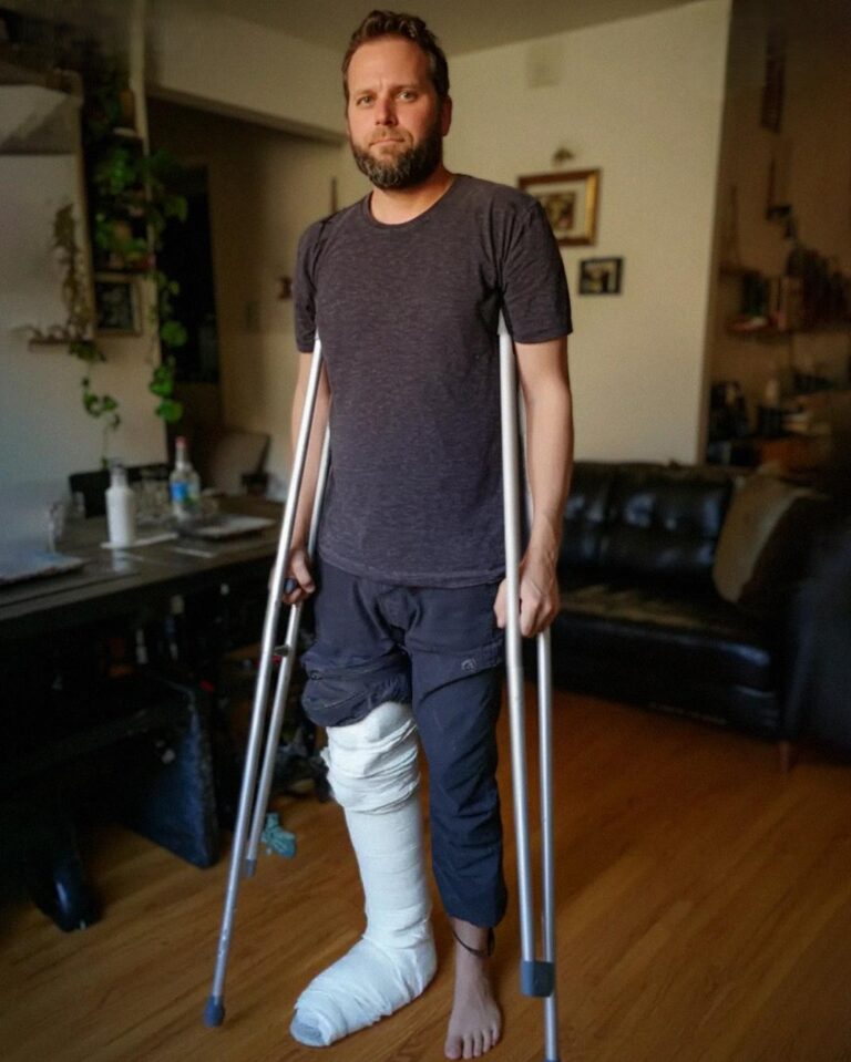 My Husband Showed Up with a Cast on His Leg the Day Before Our First Family Vacation – Then I Got a Call That Changed Everything