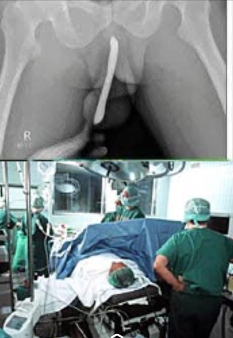 Girl had to be hospitalized for wanting to use a pe..