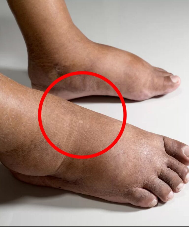 These are the consequences of sleeping with…