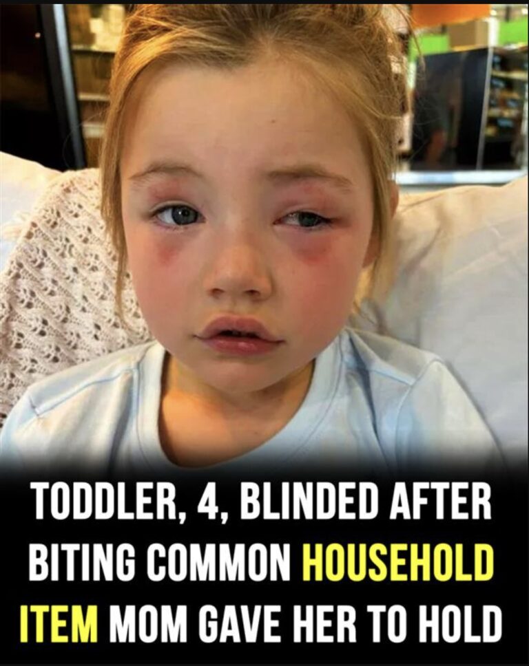 Todler, 4, blinded after biting common household item mom gave her to hold