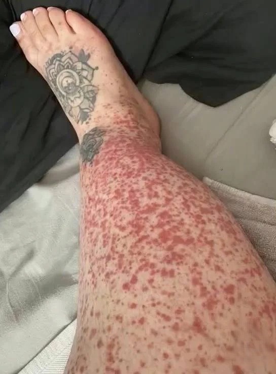 Never Knew these are the consequences of sleeping with?!